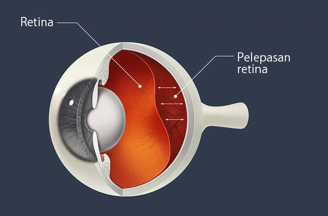 retina mata